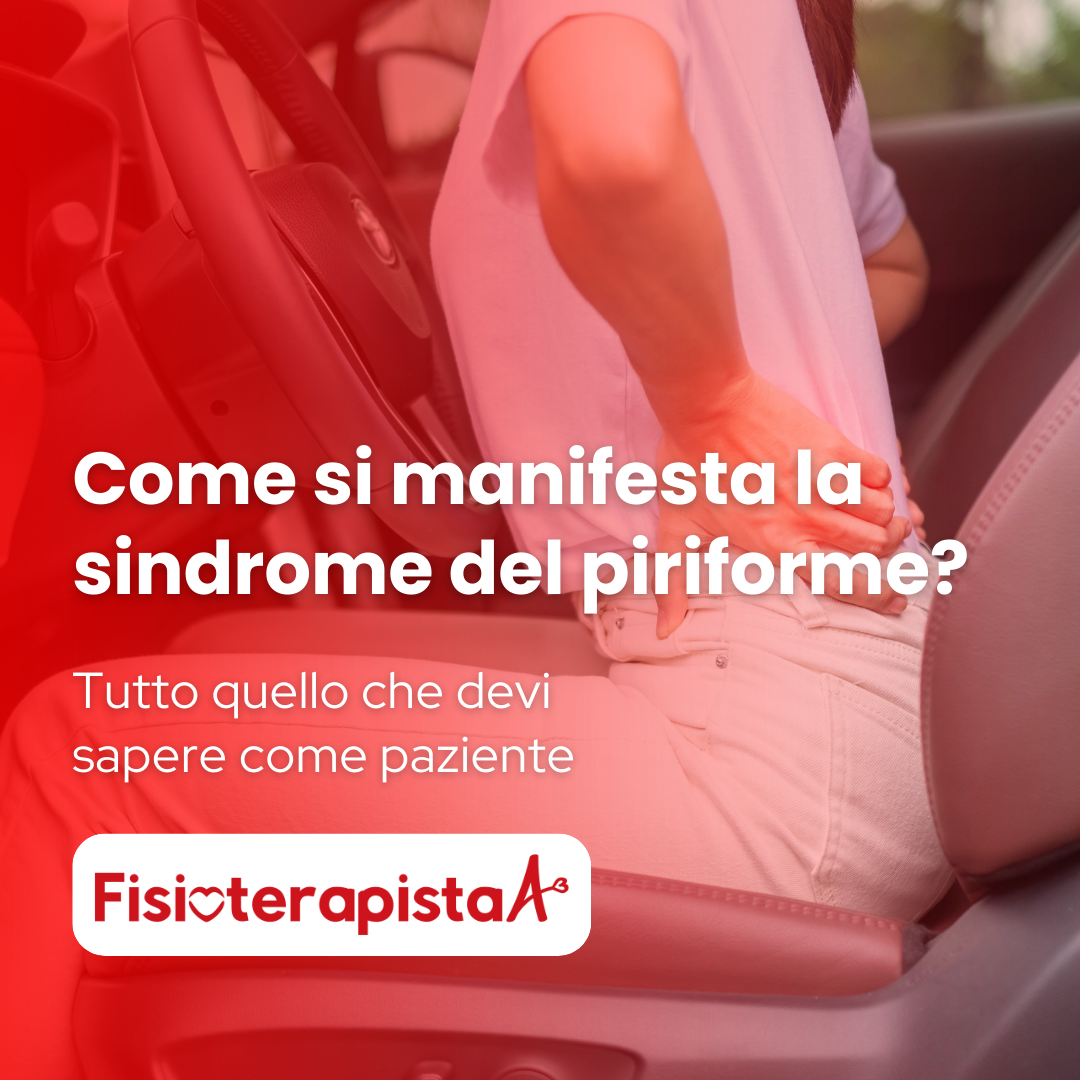 Sindrome del piriforme: sintomi e manifestazioni principali